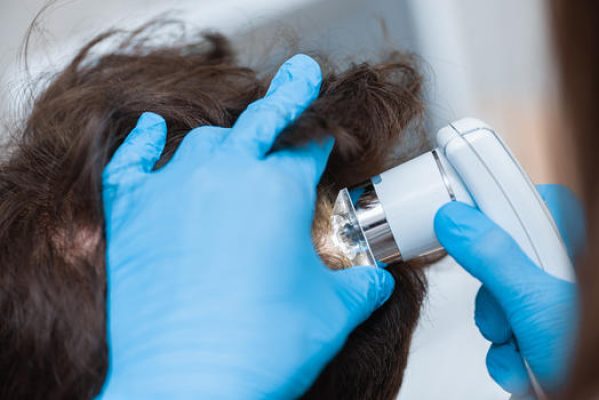 Important of Hair & Scalp Analysis