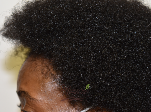 Before and after hair result showing improved fullness