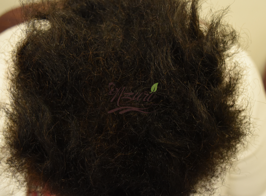 Before and after crown result showing improved fullness