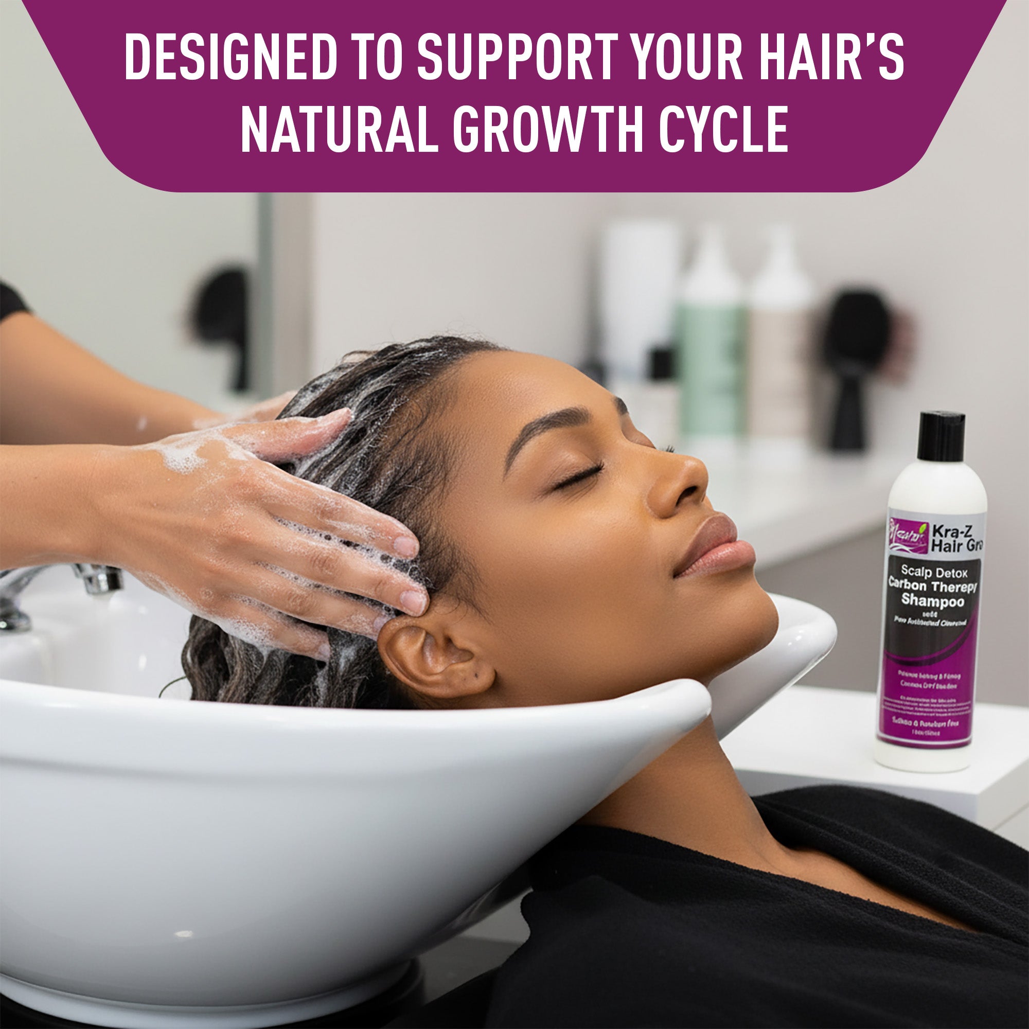 Nzuri Kra-Z Hair Scalp Carbon Therapy Shampoo Seborrheic Dermatitis 12oz