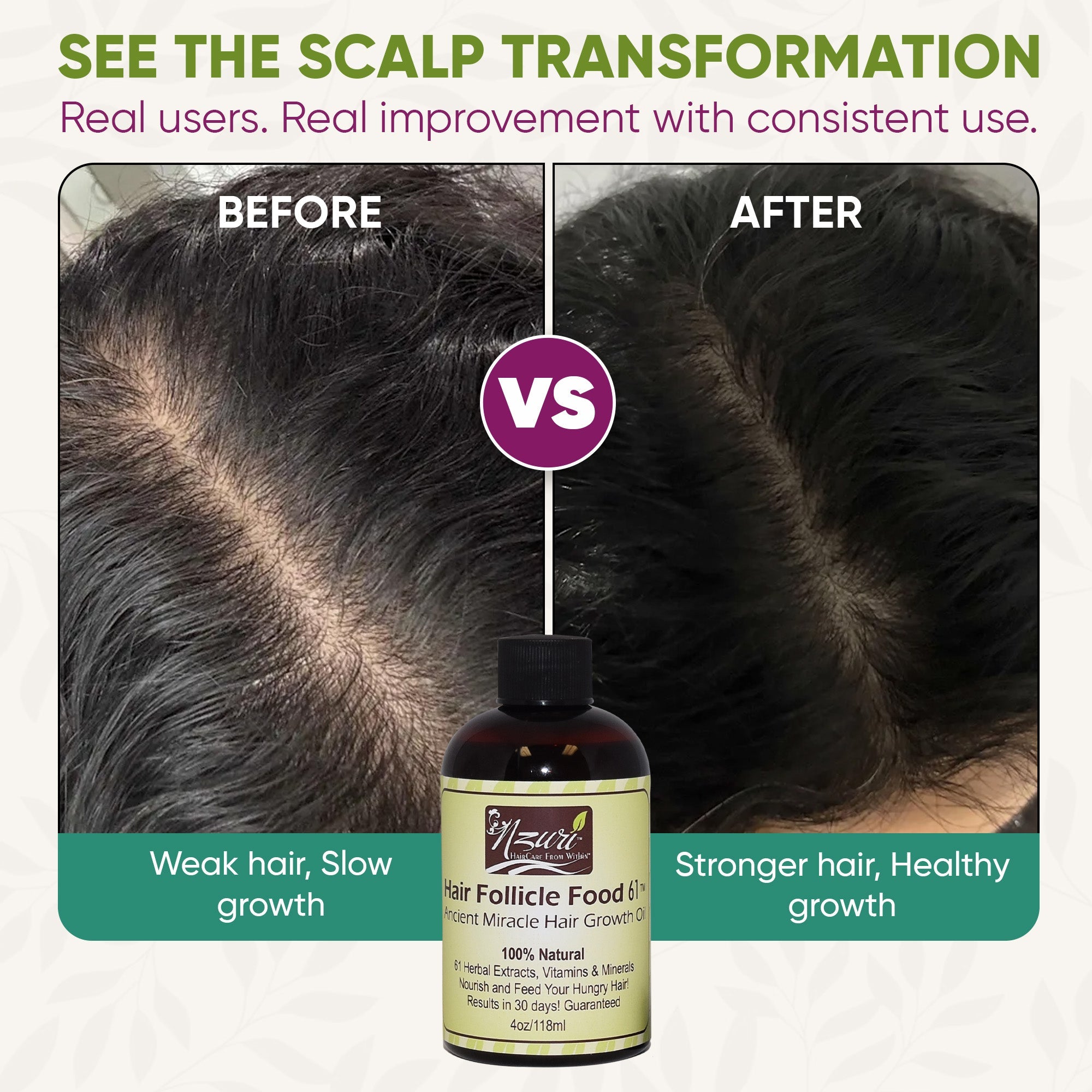 Nzuri Hair Follicle Food 61- Ancient Miracle Hair Growth Oil™ 4oz.